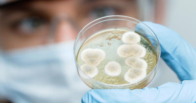 Scientist holding a petri dish with bacterial colonies growing in media